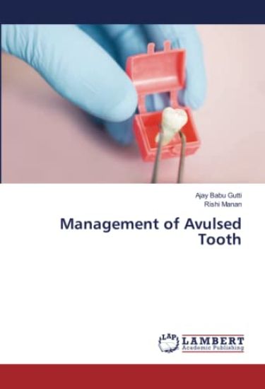 Management of Avulsed Tooth – Ajay Babu Gutti, kirjan kansikuva