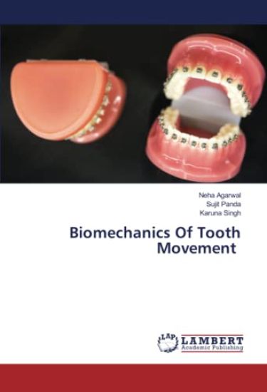 Biomechanics Of Tooth Movement