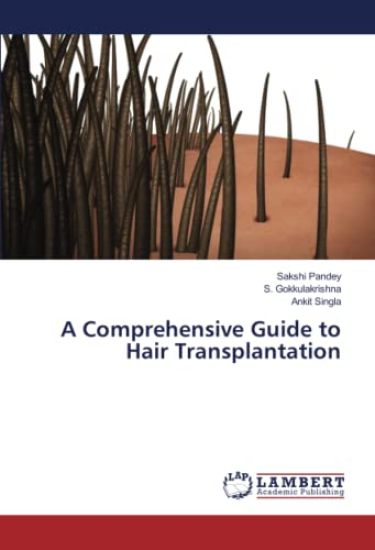 A Comprehensive Guide to Hair Transplantation