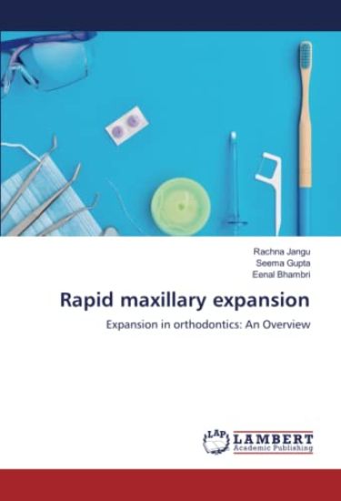 Rapid maxillary expansion