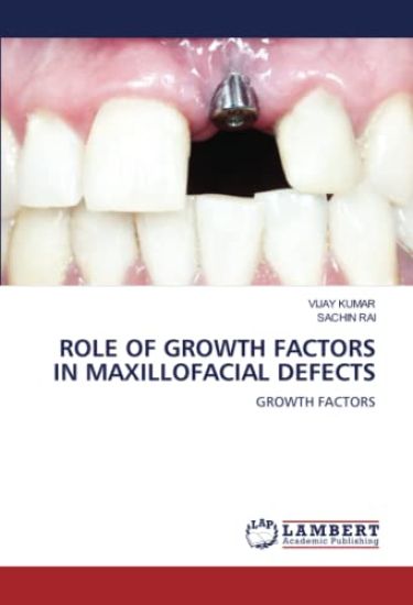 ROLE OF GROWTH FACTORS IN MAXILLOFACIAL DEFECTS