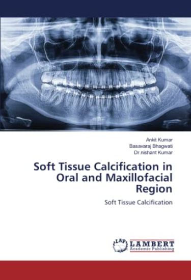 Soft Tissue Calcification in Oral and Maxillofacial Region