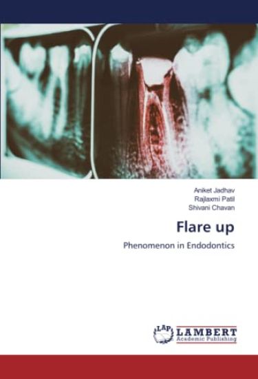 Flare up
