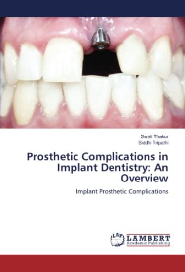 Prosthetic Complications in Implant Dentistry: An Overview
