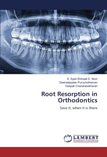 Root Resorption in Orthodontics