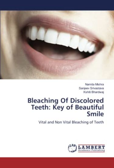 Bleaching Of Discolored Teeth: Key of Beautiful Smile