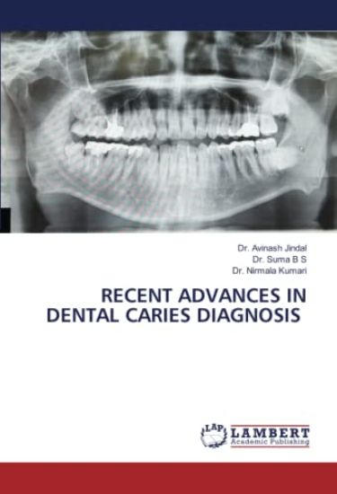 RECENT ADVANCES IN DENTAL CARIES DIAGNOSIS