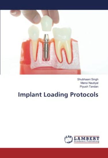 Implant Loading Protocols