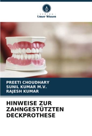 HINWEISE ZUR ZAHNGESTÜTZTEN DECKPROTHESE