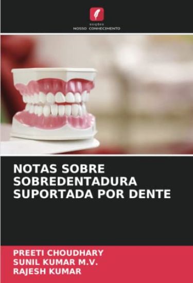 NOTAS SOBRE SOBREDENTADURA SUPORTADA POR DENTE