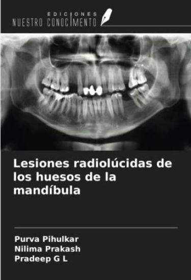 Lesiones radiolúcidas de los huesos de la mandíbula