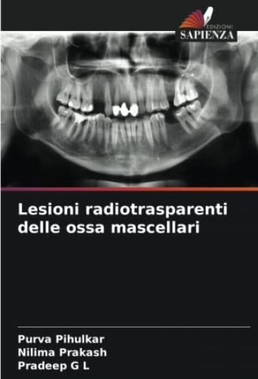 Lesioni radiotrasparenti delle ossa mascellari