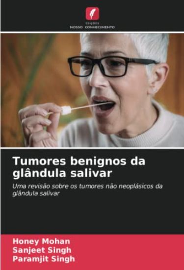 Tumores benignos da glândula salivar
