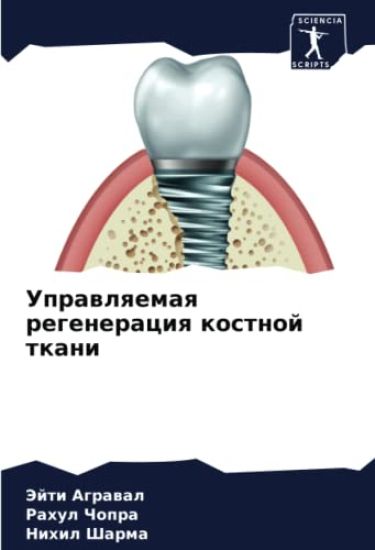 Uprawlqemaq regeneraciq kostnoj tkani