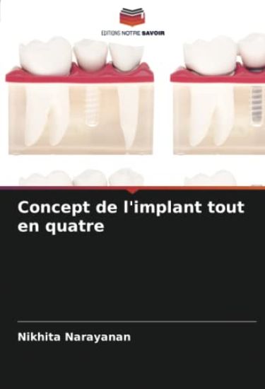 Concept de l'implant tout en quatre