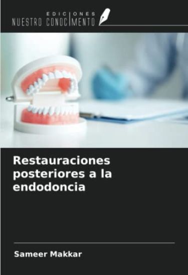 Restauraciones posteriores a la endodoncia – Sameer Makkar, kirjan kansikuva