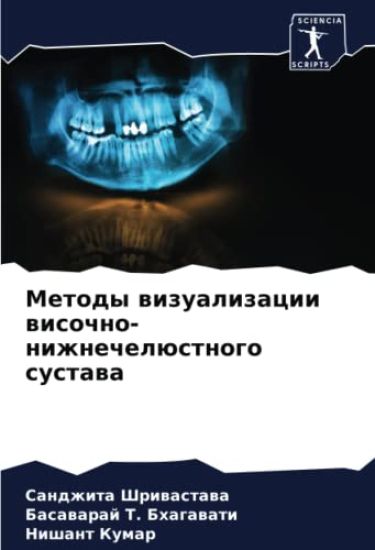 Metody wizualizacii wisochno-nizhnechelüstnogo sustawa
