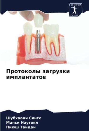 Protokoly zagruzki implantatow
