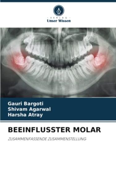 BEEINFLUSSTER MOLAR