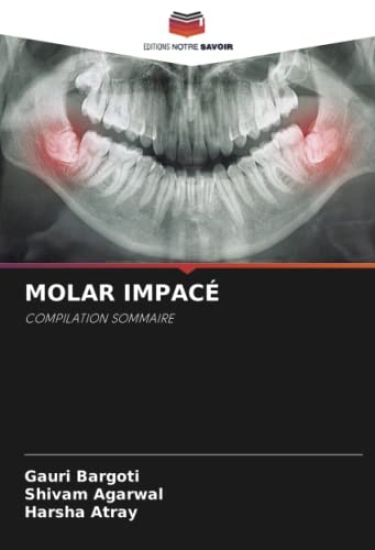 MOLAR IMPACÉ