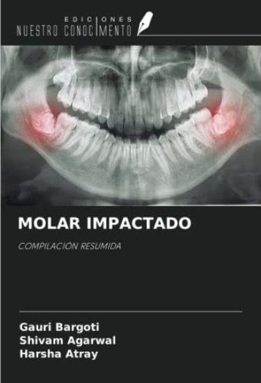 MOLAR IMPACTADO