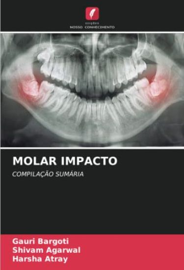 MOLAR IMPACTO