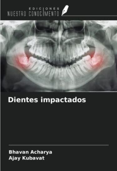 Dientes impactados