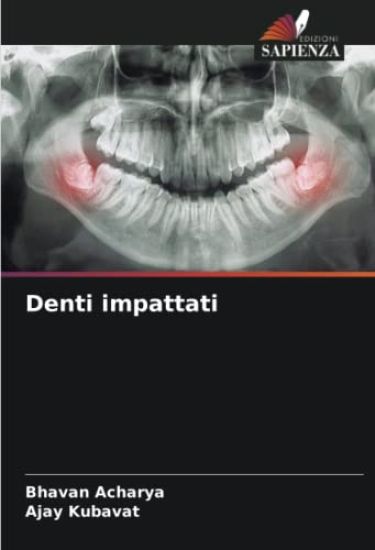 Denti impattati