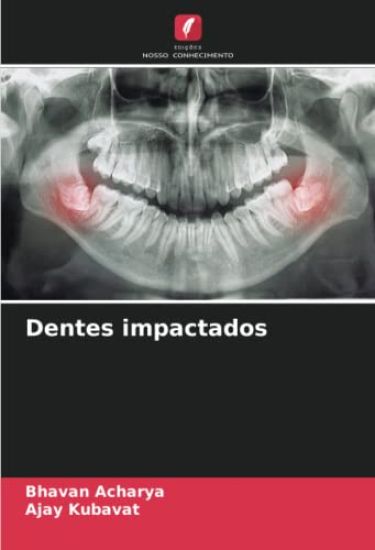 Dentes impactados