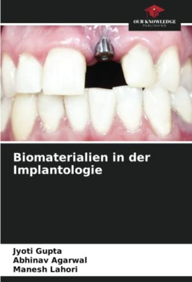 Biomaterialien in der Implantologie