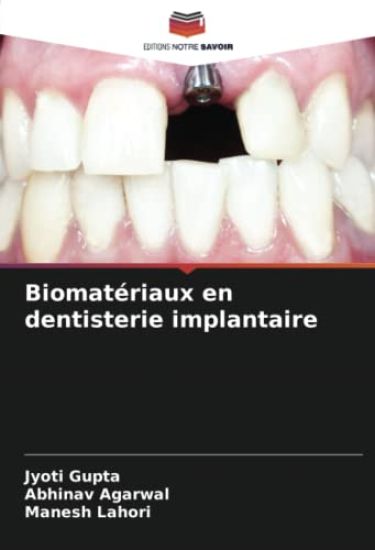 Biomatériaux en dentisterie implantaire