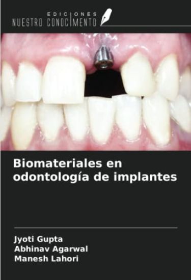 Biomateriales en odontología de implantes