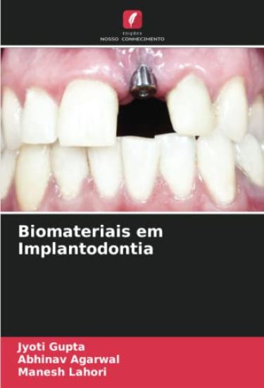 Biomateriais em Implantodontia