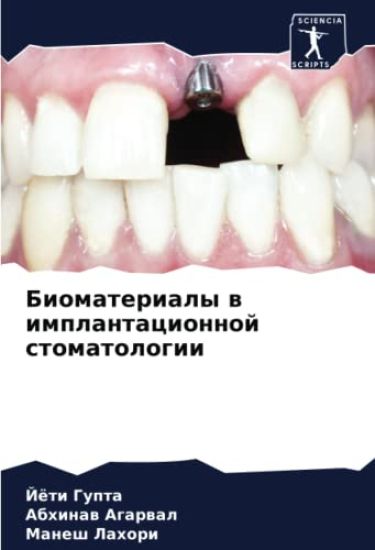 Biomaterialy w implantacionnoj stomatologii