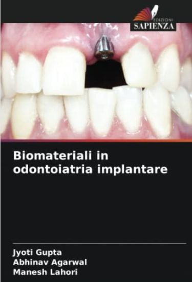 Biomateriali in odontoiatria implantare