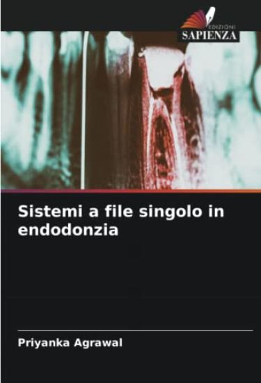 Sistemi a file singolo in endodonzia