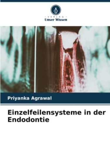 Einzelfeilensysteme in der Endodontie