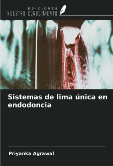 Sistemas de lima única en endodoncia