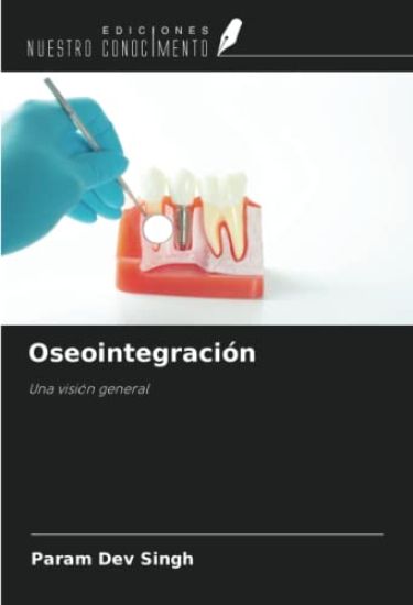 Oseointegración
