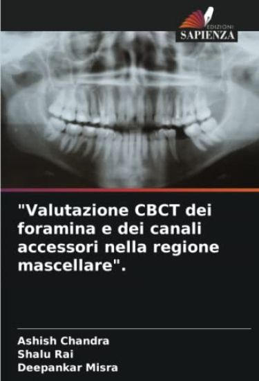 "Valutazione CBCT dei foramina e dei canali accessori nella regione mascellare".