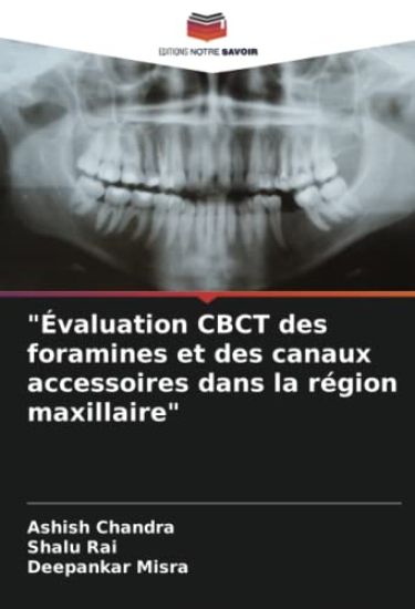 "Évaluation CBCT des foramines et des canaux accessoires dans la région maxillaire"
