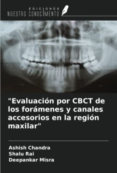 "Evaluación por CBCT de los forámenes y canales accesorios en la región maxilar"