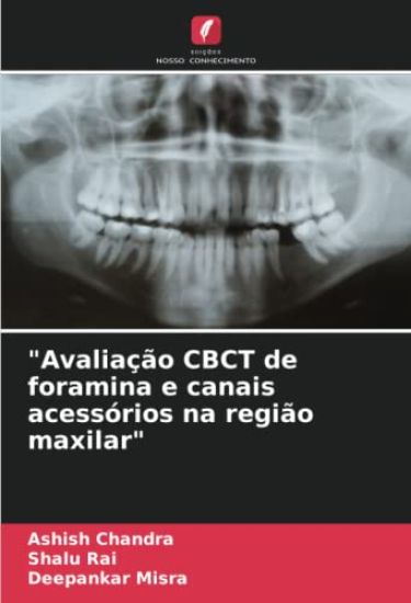 "Avaliação CBCT de foramina e canais acessórios na região maxilar"