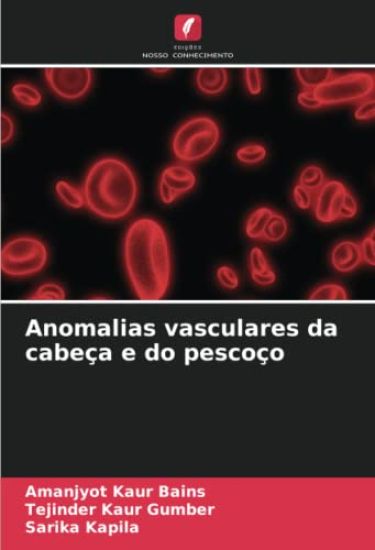 Anomalias vasculares da cabeça e do pescoço