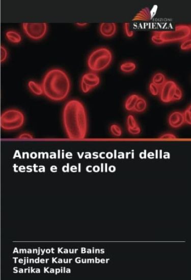 Anomalie vascolari della testa e del collo