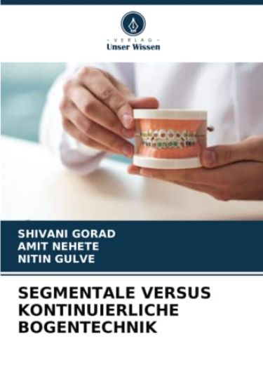SEGMENTALE VERSUS KONTINUIERLICHE BOGENTECHNIK
