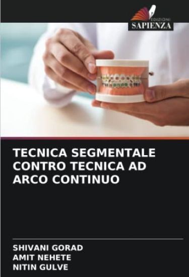 TECNICA SEGMENTALE CONTRO TECNICA AD ARCO CONTINUO
