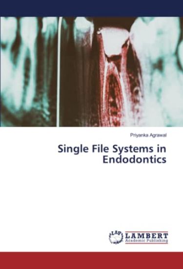Single File Systems in Endodontics