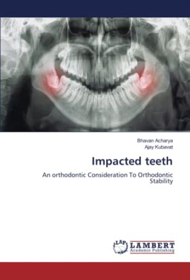 Impacted teeth