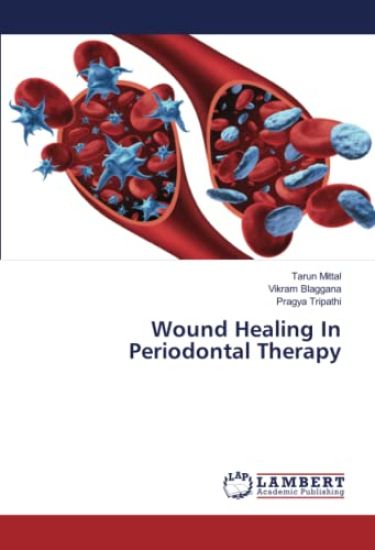 Wound Healing In Periodontal Therapy